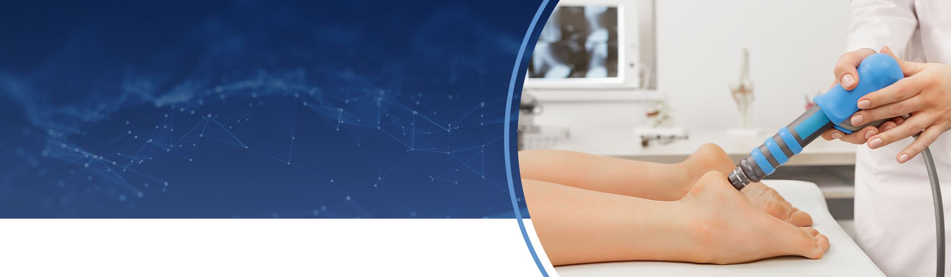 Epat treatment on sale for plantar fasciitis