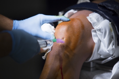 Doctor’s hand administering a lubrication injection into a patient’s knee to relieve joint pain and improve mobility